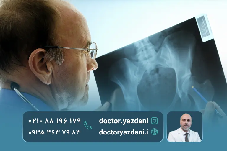 علایُِم درمان نکردن آواسکولار